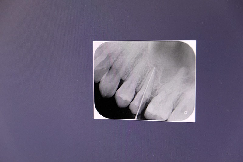 20251109-116qz 20251109-116qz